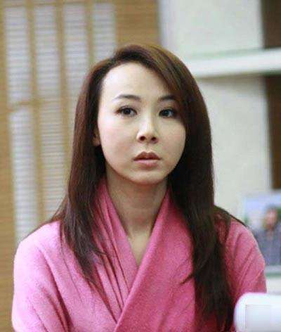 老演员整容脸变形,老年人整容前后照片