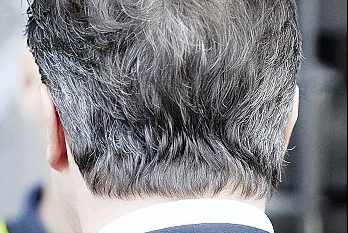 白头发越长越多缺什么营养,改善白头发生长有哪些营养素