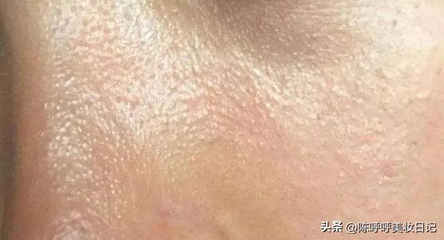 适合夏天用的爽肤水推荐,适合夏天用的大牌爽肤水