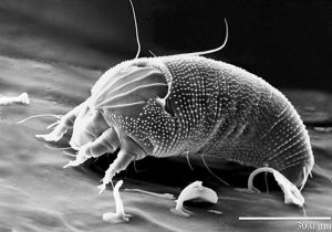 螨虫的危害及防治方法,螨虫危害以及如何除螨虫