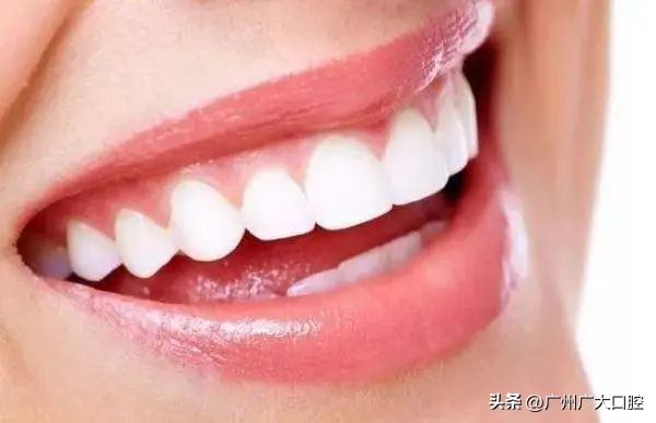 牙齿美白最好的方法又省钱,牙齿美白的4种方法亲测有效