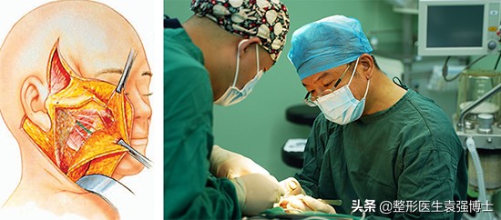 新手医生做拉皮手术可靠吗,北京八大处拉皮手术费多少钱