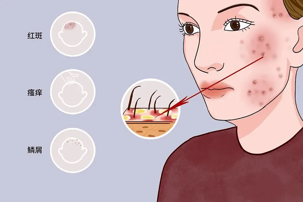 过敏体质是免疫力低还是免疫力高,过敏体质到底是免疫力强还是弱