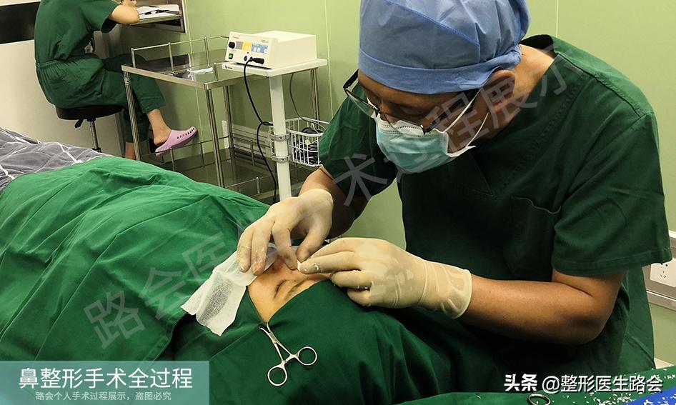 隆鼻手术全过程女生,隆鼻手术到底是怎么进行的