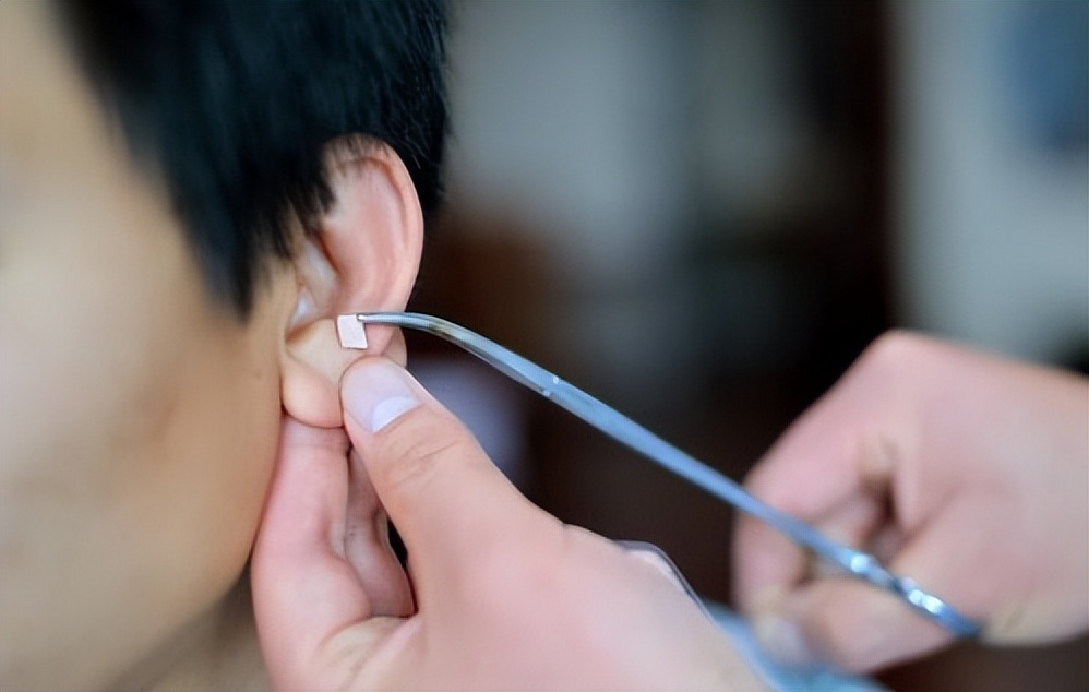 表情不受管理怎么办,表情不受控制是什么病