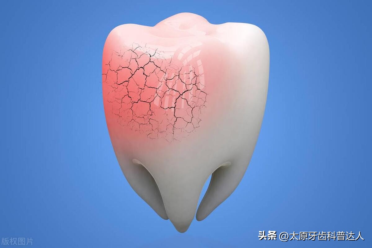 牙齿竟然开裂，这该怎么办才好？