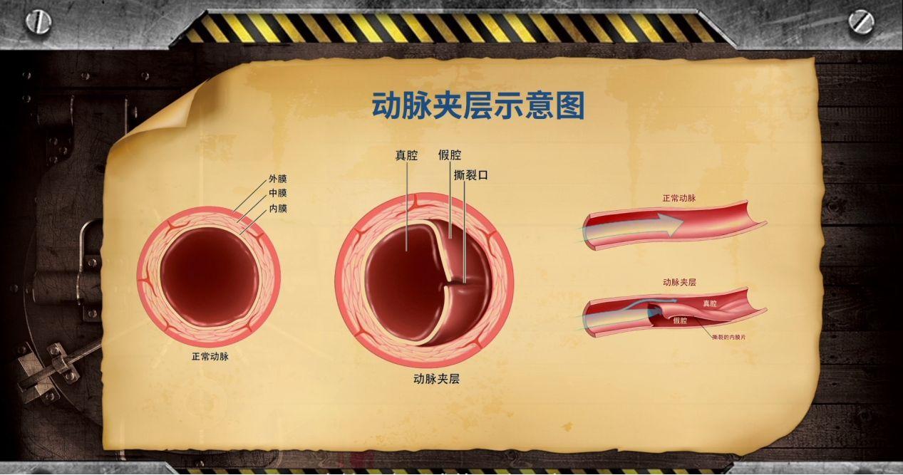 心脏病后背痛和肺癌后背痛的区别,58岁后背疼痛怎么回事