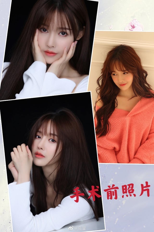 整容毁容照片女,初见相貌平平再见魅力爆表