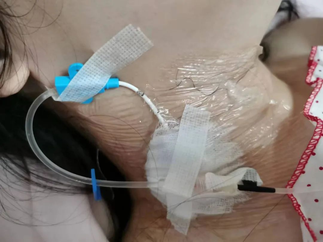 200/135mmHg！孕33周准妈妈血压“爆表”，母婴命悬一线......