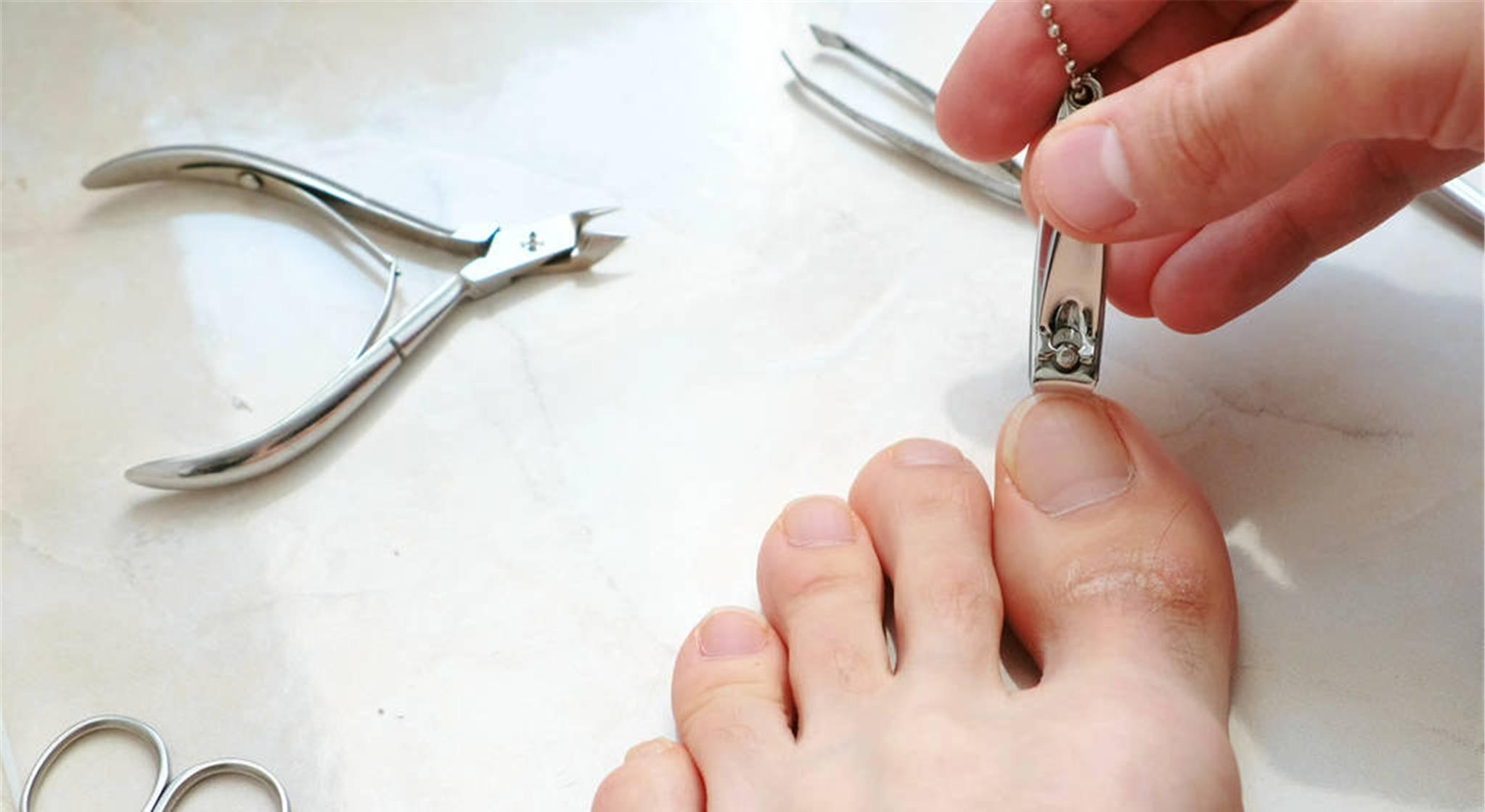 治甲沟炎，必须拔指甲？医生教你一招，在家就能缓解