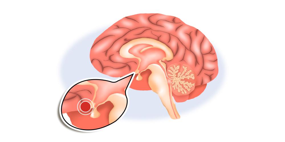 小婴儿也会来大姨妈吗,宝宝10个月了第一次来大姨妈