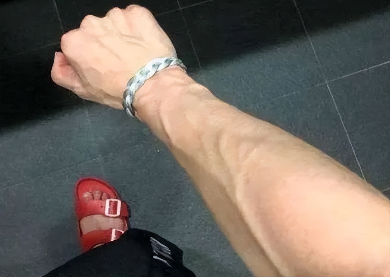 胳膊青筋手背青筋多是怎么回事,人体青筋明显是什么问题