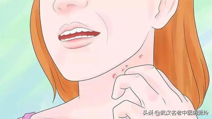 孩子皮肤干燥粗糙痒总是挠破,皮肤有一块干燥粗糙还特别痒