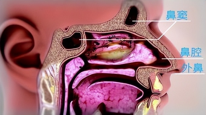 鼻分泌物中客观标志物，在不同鼻炎中的，临床应用。
