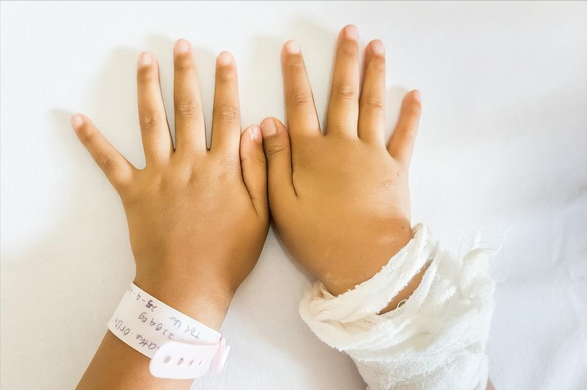 肝功能化验结果怎么看,肝功能检查如何看报告