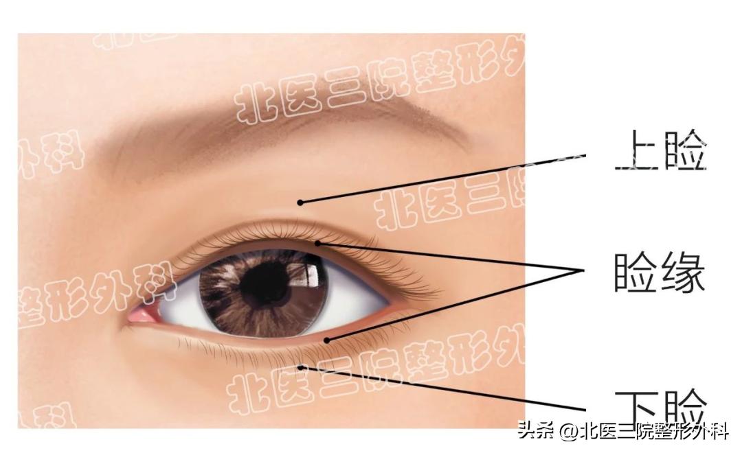 睫毛根部长了痦子怎么回事,眼睫毛根部长痣