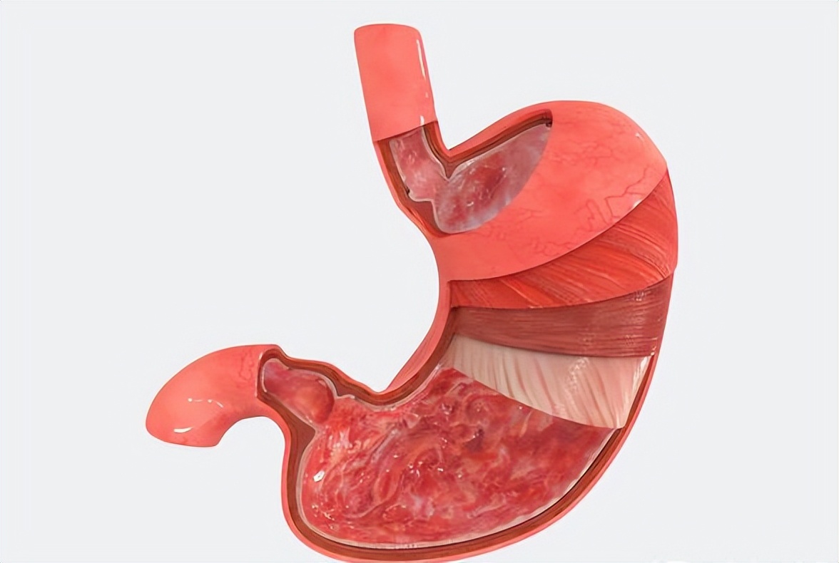 胃窦炎反酸烧心怎么办,胃窦炎引起胃胀疼吃什么药