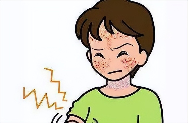 脂溢性皮炎吃什么维生素,头皮脂溢性皮炎用什么药