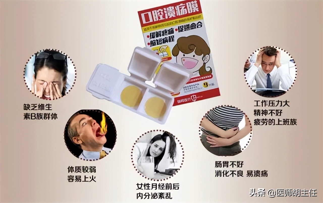 口腔溃疡为什么要吃维生素来治疗,缺乏维生素口腔溃疡应该吃什么药