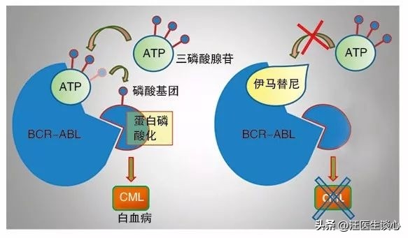 费城染色体阳性的急性髓系白血病,慢性粒细胞白血病的染色体标记