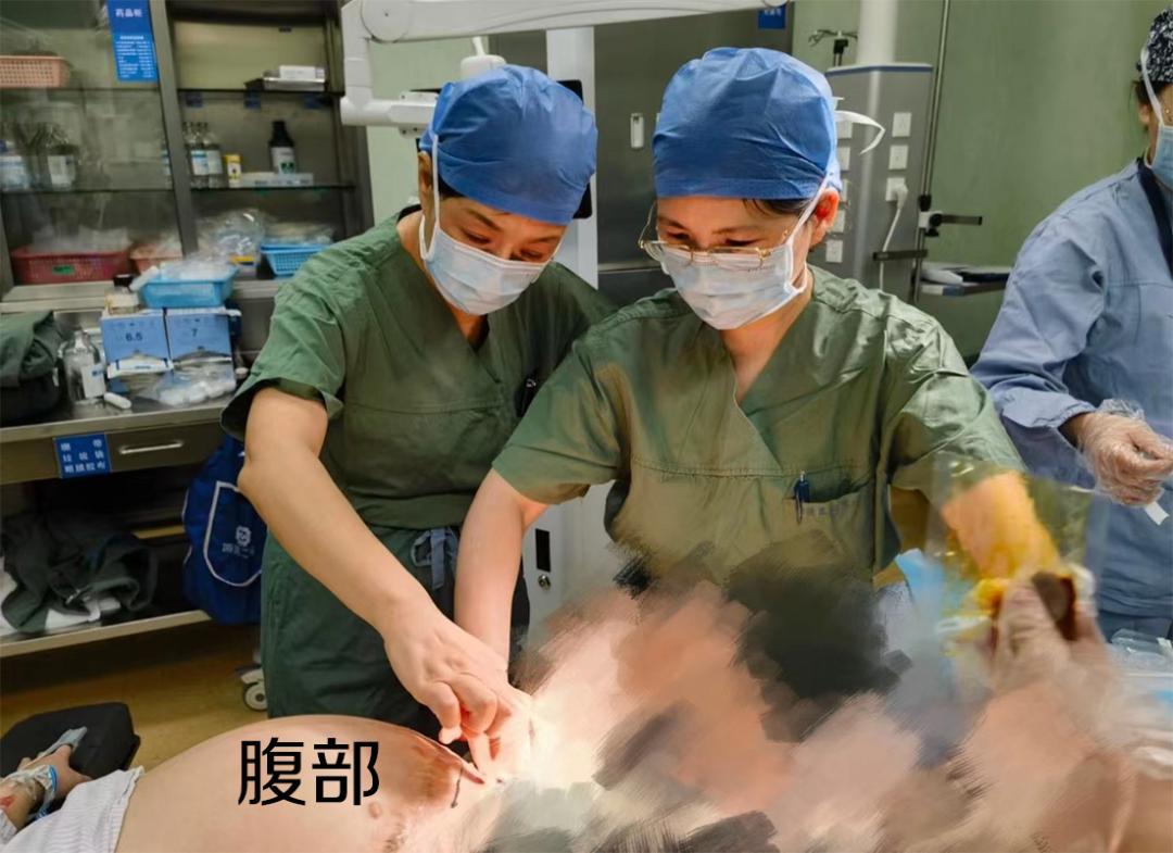 被车碾压的女孩救活了么,被大货车碾过的人