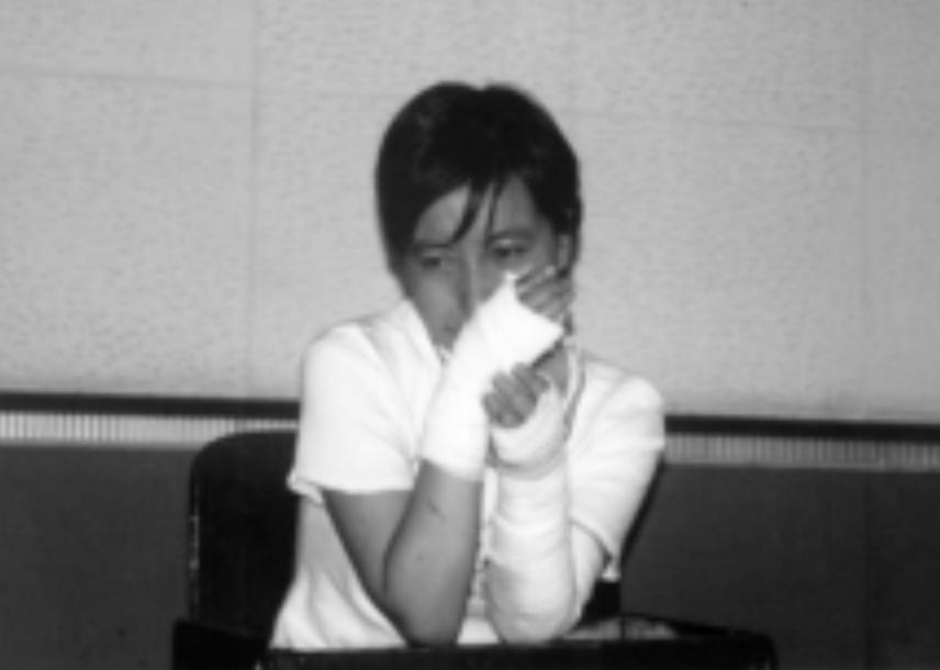 15岁妙龄少女被烧伤,19岁花季少女被烧伤后续