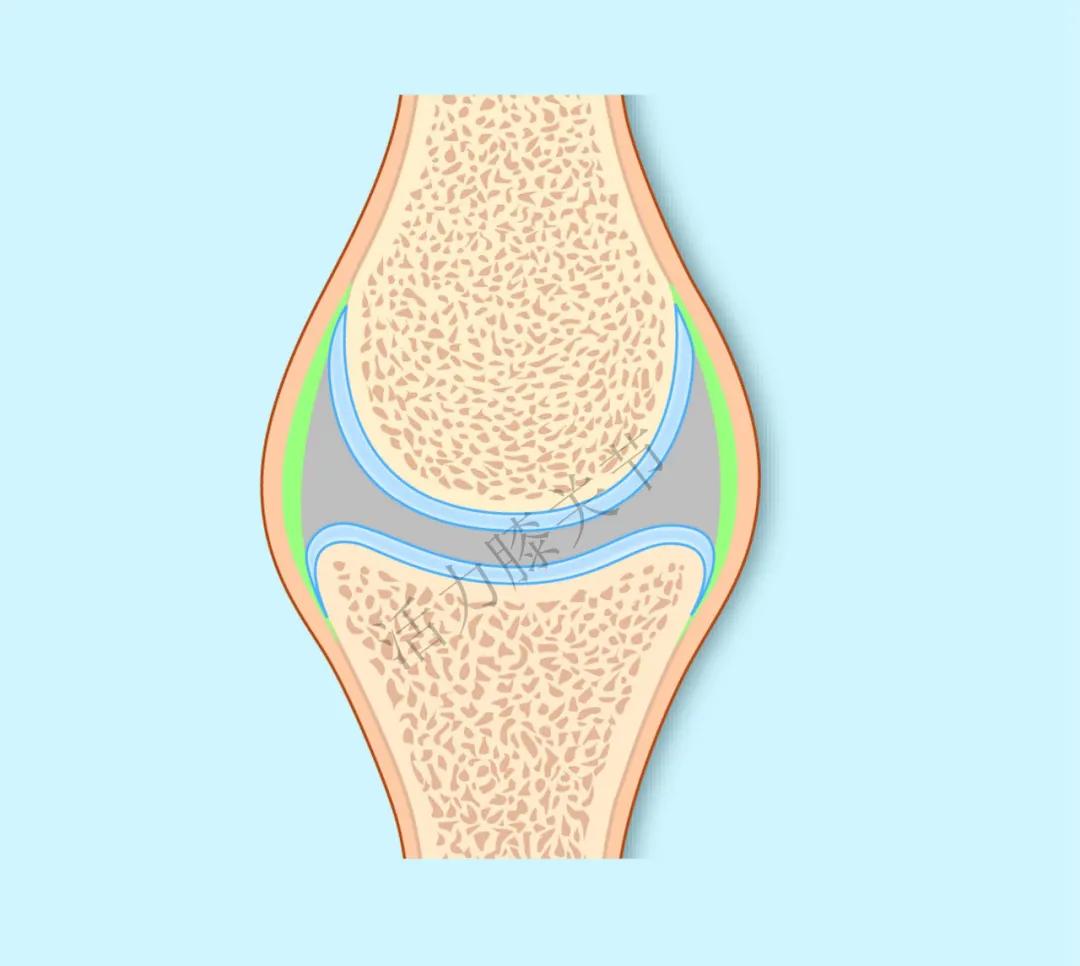 骨关节炎是如何产生的,骨关节炎的形成机制