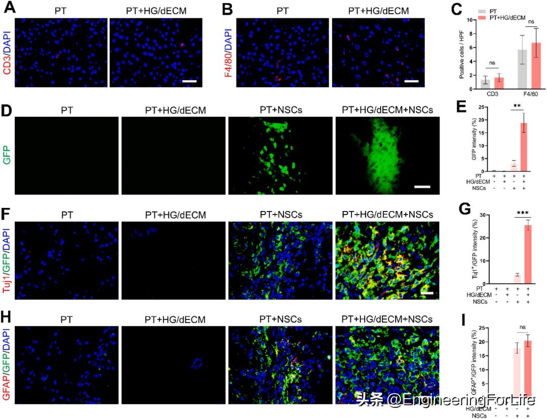 缺血性卒中干细胞,水凝胶干细胞