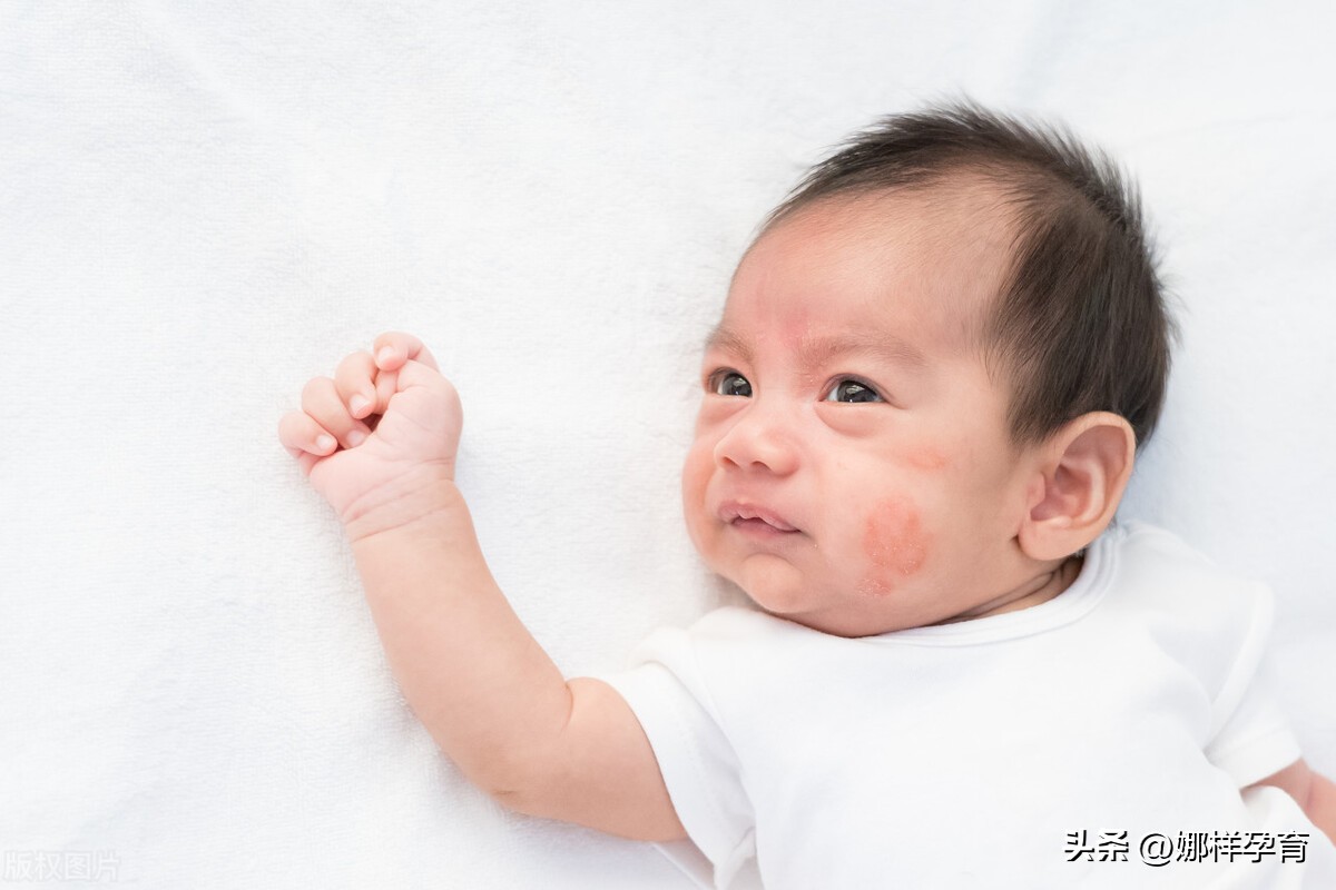 7个月的宝宝手心发红还有点烫,4个月宝宝手心发热红是怎么了