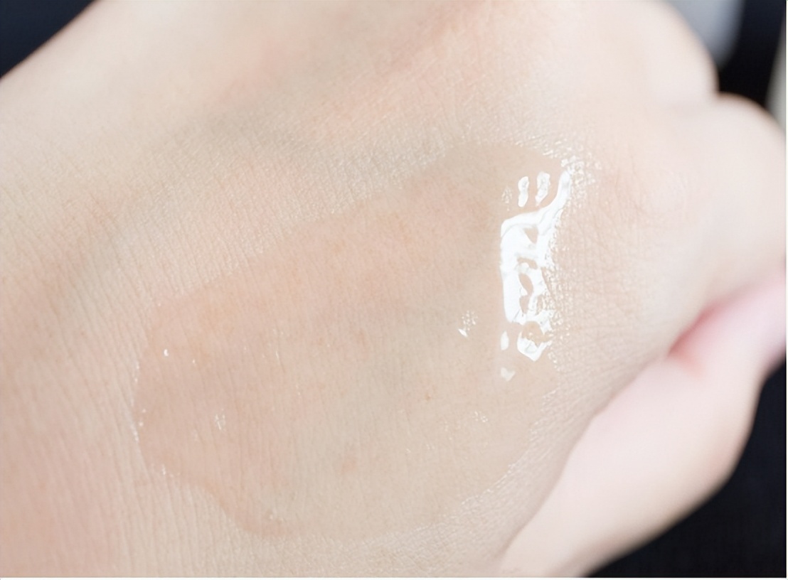 手脱皮开裂痒长癣专用乳膏,手脱皮手癣怎么回事