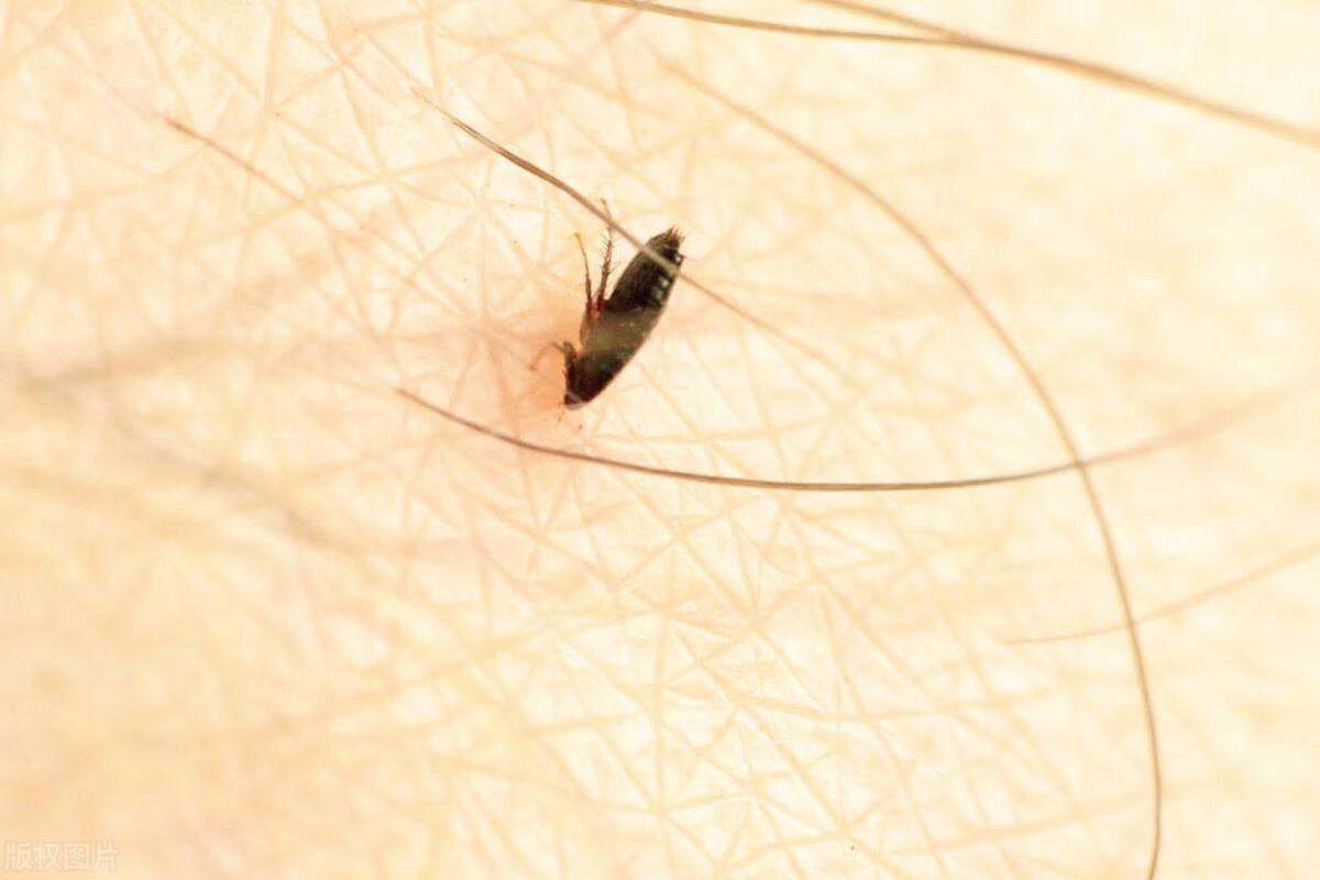 家里有跳蚤怎么快速的捕捉跳蚤,如何找到跳蚤并消灭掉