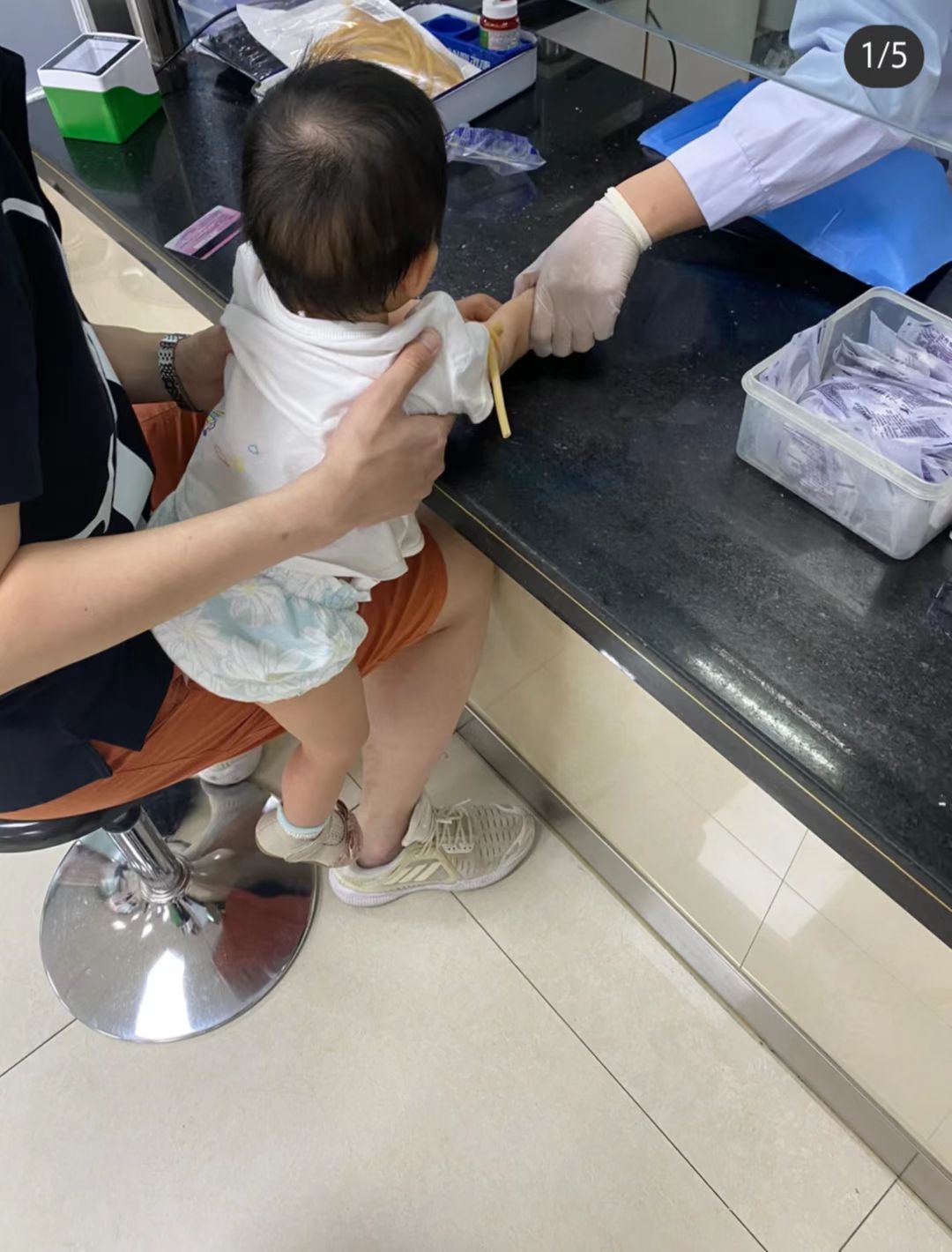 22岁女孩腿上有红色紫色小点点,小孩腿上有瘀斑需要做骨髓穿刺吗