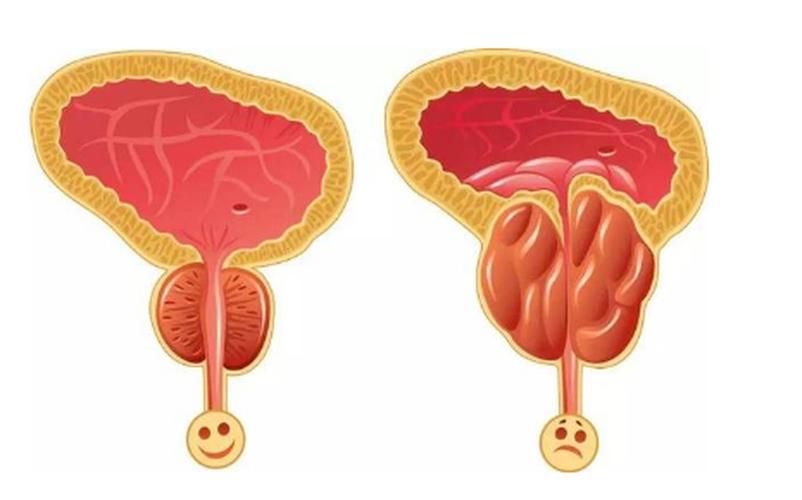 跷二郎腿的危害会造成o型腿吗,跷二郎腿的危害解剖图