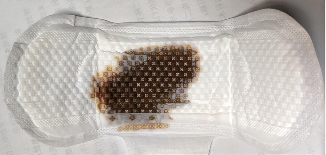 什么样的大姨妈,什么样的大姨妈才是正常