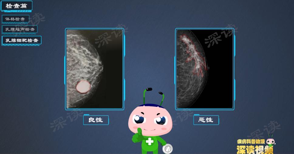 乳房有点增生怎么办,螺内酯副作用乳腺增生