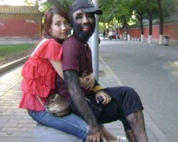 当年轰动一时的“毛孩”：42岁娶90后娇妻，生下一子未遗传长毛