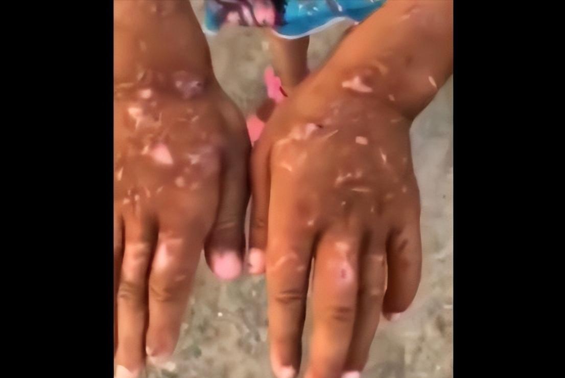 小女孩疑遭父母当街残忍虐待后续,虐待殴打儿童家庭暴力事件