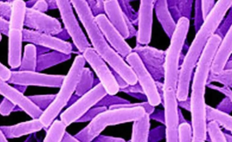 沉睡多年病毒再次复苏,潘多拉病毒真的复活了吗