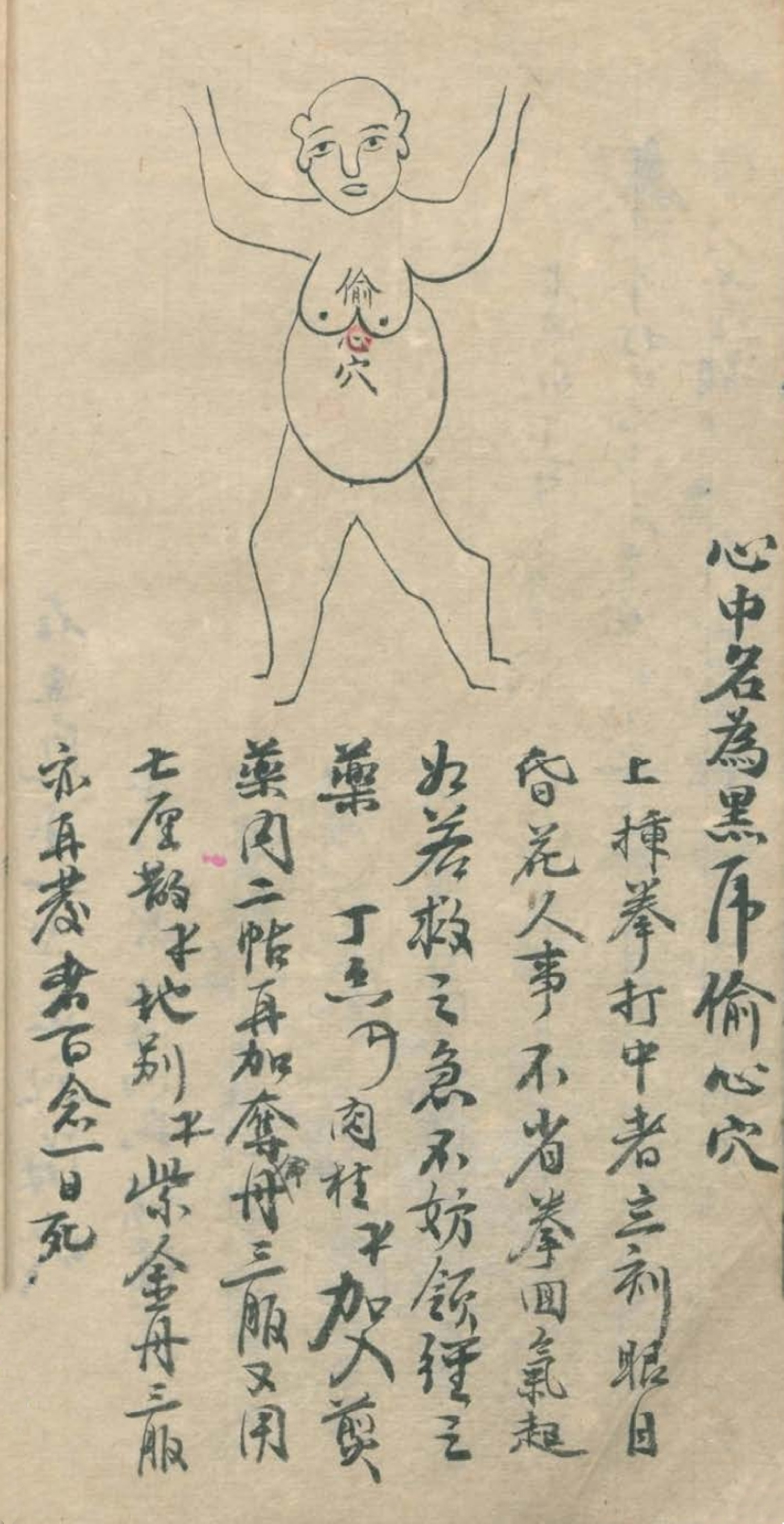 武当秘传跌打八法,民间中医古籍手抄本专医跌打秘方