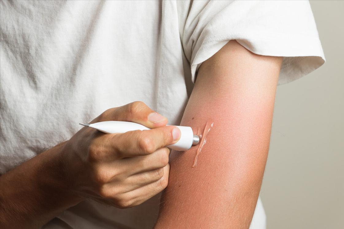 红霉素软膏淡斑真的有效吗,2块钱的红霉素软膏能祛斑吗