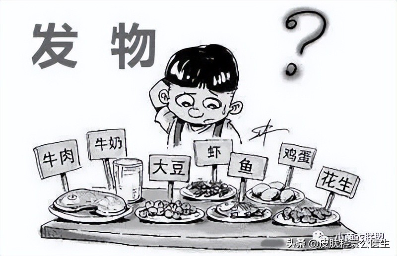 皮肤病忌口发物都包括牛奶吗,发物忌口期间吃什么比较好