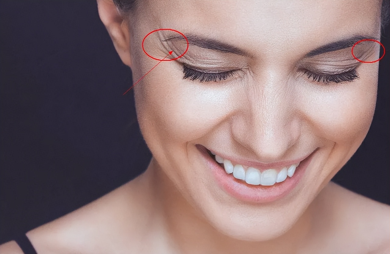 去皱纹的护肤小妙招,淡化皱纹抗皱注意事项