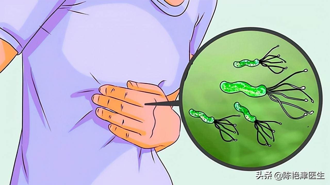 胃癌最大的祸根是幽门螺杆菌，想要彻底杀菌，记住3个办法