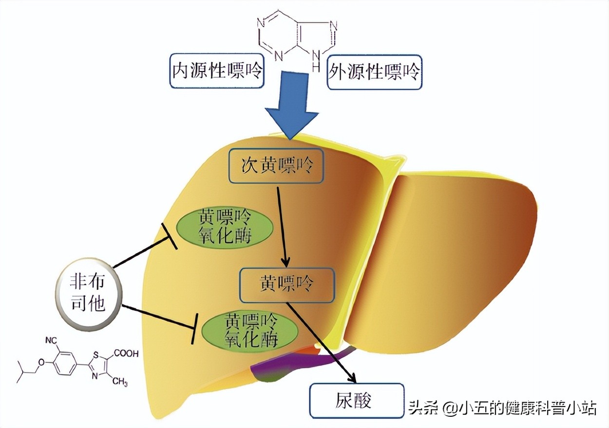 非布司他怎么吃可以根治痛风,吃非布司他痛风发作脚红肿怎么办