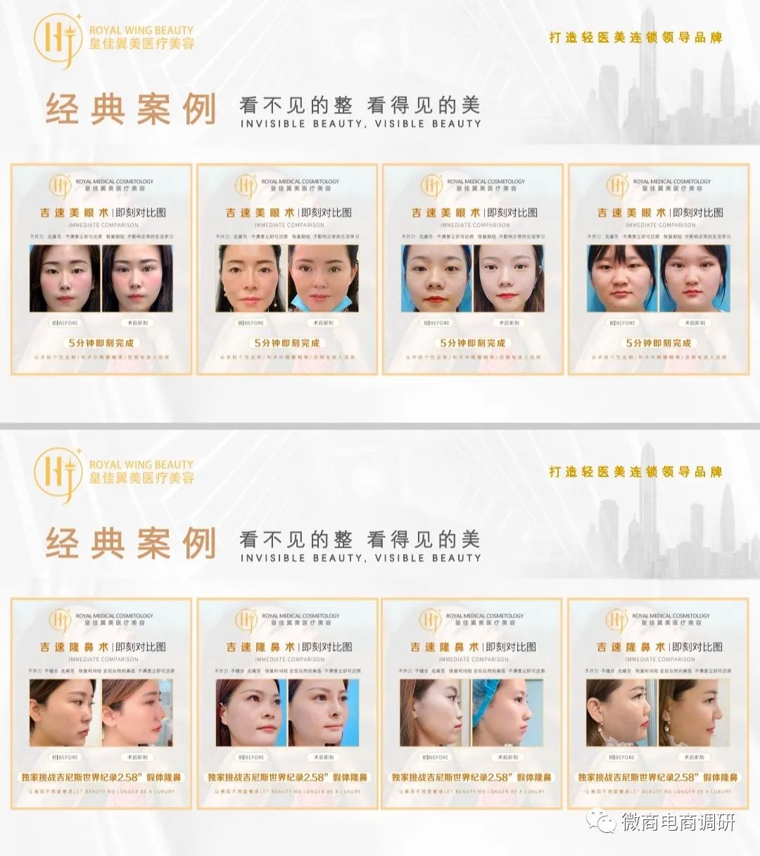 不开刀不手术零风险丰胸,不手术不开刀无痛丰胸