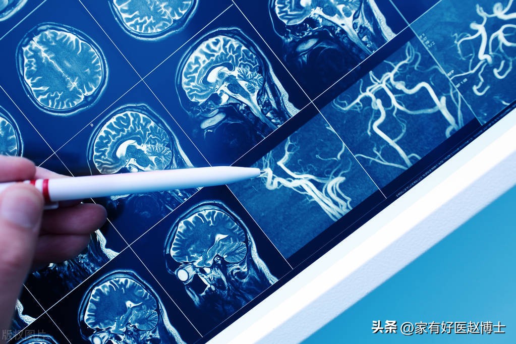 降压药吃了后头晕是什么原因,吃了降压药头有点晕怎么回事