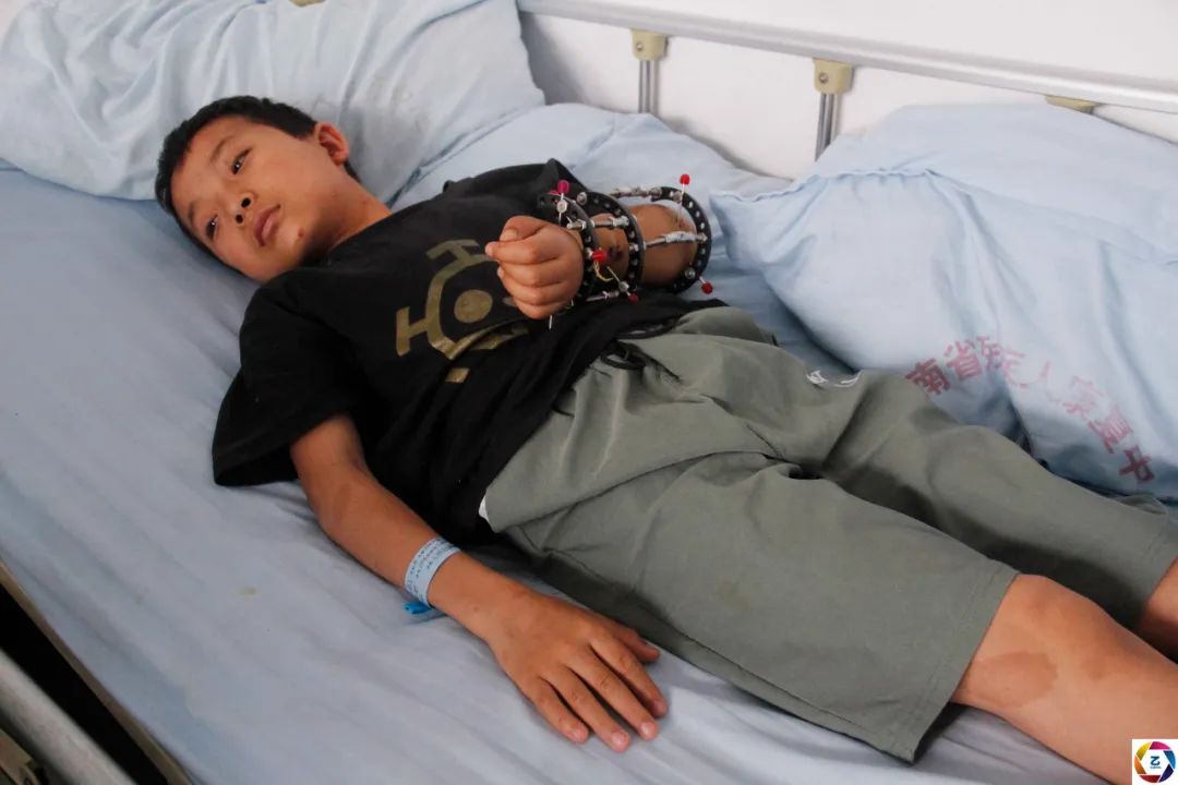 男子被石头砸伤怎么办,小男孩被石头砸到后续