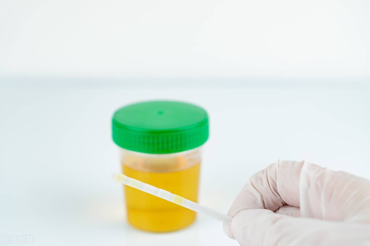 尿蛋白怎么控制才能消失,尿蛋白怎么控制不会复发