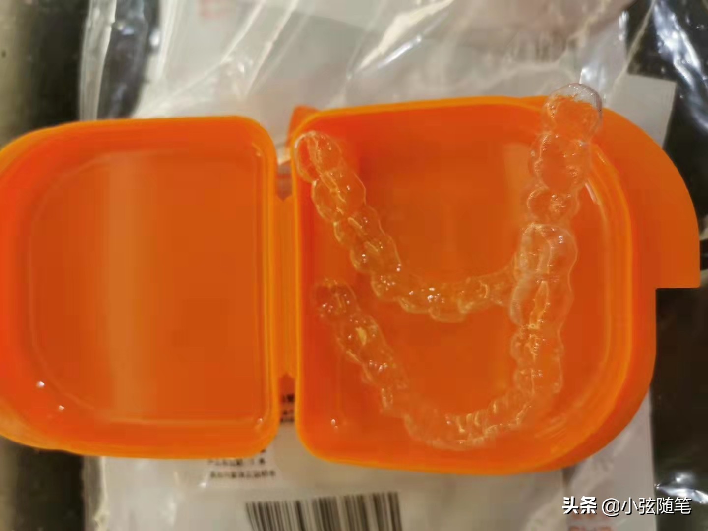 隐形矫正牙齿一万多,牙齿矫正和隐形牙齿矫正的全过程