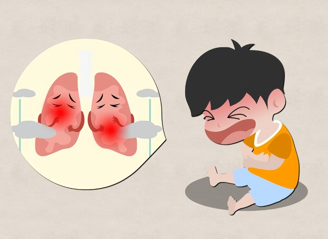 小儿肺炎严重的后果,严重的小儿肺炎怎么治疗